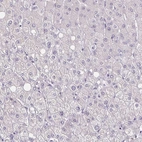 Immunohistochemical staining of human liver shows low expression as expected.