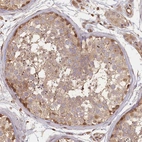 Immunohistochemical staining of human testis shows moderate cytoplasmic positivity in cells in seminiferous ducts.