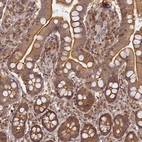 Immunohistochemical staining of human small intestine shows moderate cytoplasmic positivity in glandular cells.