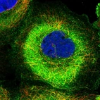 Immunofluorescent staining of human cell line A-431 shows localization to plasma membrane & cytosol.