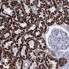 Anti-ELP4 Antibody