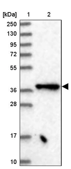 Lane 1: Marker [kDa] 250, 130, 95, 72, 55, 36, 28, 17, 10_br/_Lane 2: Human cell line RT-4