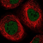 Immunofluorescent staining of human cell line A-431 shows localization to nucleoplasm.