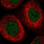 Immunofluorescent staining of human cell line A-431 shows localization to nucleoplasm.