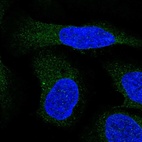 Immunofluorescent staining of human cell line U-2 OS shows localization to endoplasmic reticulum.