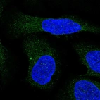 Immunofluorescent staining of human cell line U-2 OS shows localization to endoplasmic reticulum.