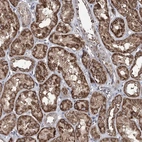 Anti-ACTR6 Antibody