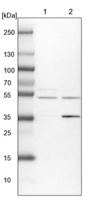 Lane 1: NIH-3T3 cell lysate (Mouse embryonic fibroblast cells)_br/_Lane 2: NBT-II cell lysate (Rat Wistar bladder tumour cells)