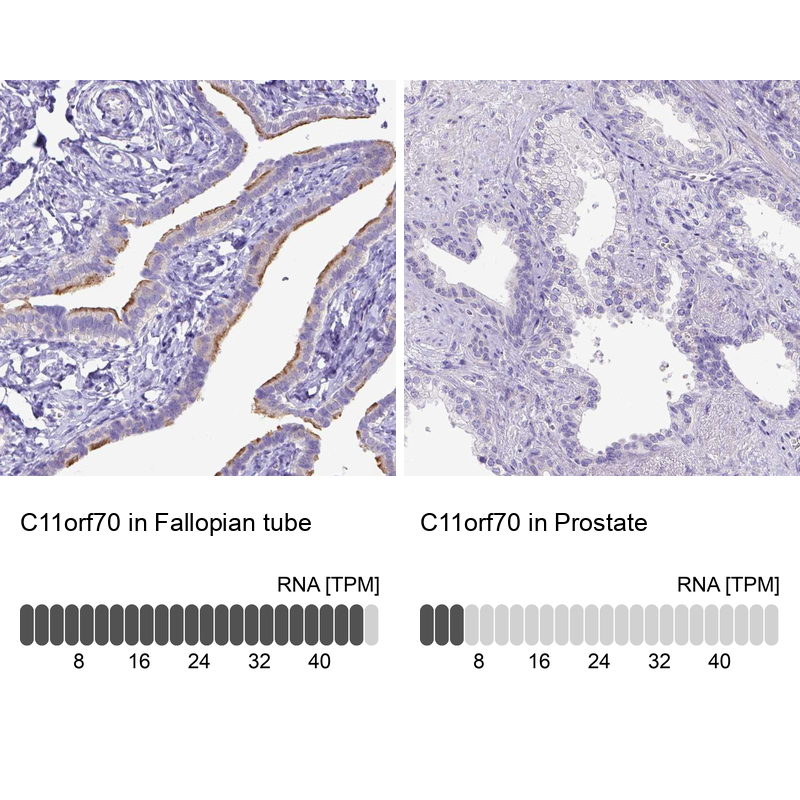 Anti-C11orf70 Antibody