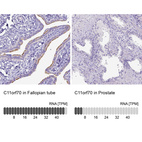 Anti-C11orf70 Antibody