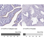 Anti-C11orf70 Antibody