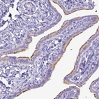 Immunohistochemical staining of human fallopian tube shows strong positivity in cilia in glandular cells.