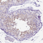 Immunohistochemical staining of human testis shows moderate cytoplasmic positivity in cells in seminiferous ducts.