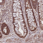 Immunohistochemical staining of human rectum shows strong cytoplasmic positivity in glandular cells.