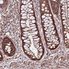 Immunohistochemical staining of human rectum shows strong cytoplasmic positivity in glandular cells.