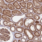 Immunohistochemical staining of human kidney shows strong cytoplasmic positivity in cells in tubules.