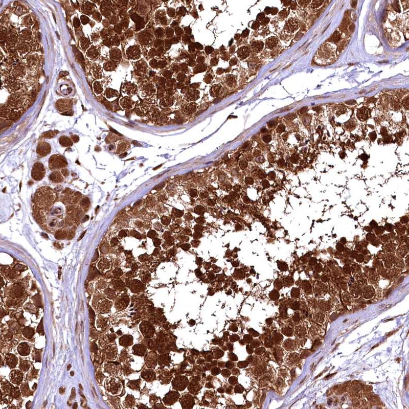 Anti-TBCEL Antibody