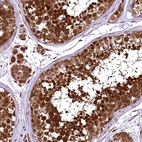 Anti-TBCEL Antibody