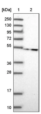 Lane 1: Marker [kDa] 250, 130, 95, 72, 55, 36, 28, 17, 10_br/_Lane 2: Human cell line RT-4