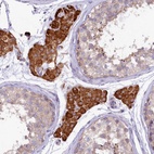 Anti-CEP295 Antibody