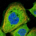 Immunofluorescent staining of human cell line A-431 shows localization to plasma membrane & cytosol.