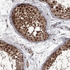 Immunohistochemical staining of human testis shows high expression.