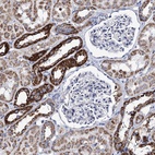 Anti-UBASH3B Antibody