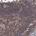 Anti-UBASH3B Antibody