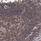 Anti-UBASH3B Antibody