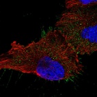 Anti-UBASH3B Antibody