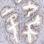Immunohistochemical staining of human prostate shows moderate nuclear positivity in glandular cells.