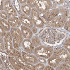 Immunohistochemical staining of human kidney shows moderate cytoplasmic and membranous positivity in cells in tubules.
