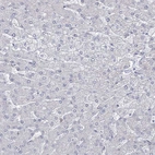 Immunohistochemical staining of human liver shows no positivity in hepatocytes as expected.