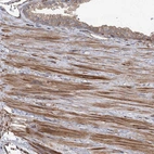 Immunohistochemical staining of human prostate shows moderate to strong cytoplasmic positivity in smooth muscle cells.