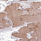Anti-CUTC Antibody