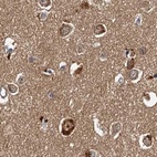 Immunohistochemical staining of human cerebral cortex using Anti-TOLLIP antibody HPA038622.