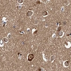 Immunohistochemical staining of human cerebral cortex using Anti-TOLLIP antibody HPA038622.
