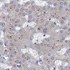 Immunohistochemical staining of human liver using Anti-TOLLIP antibody HPA038622.
