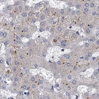 Immunohistochemical staining of human liver using Anti-TOLLIP antibody HPA038622.