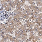 Immunohistochemical staining of human liver using Anti-TOLLIP antibody HPA038621.