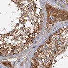 Immunohistochemical staining of human testis using Anti-TOLLIP antibody HPA038621.