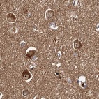 Immunohistochemical staining of human cerebral cortex using Anti-TOLLIP antibody HPA038621.