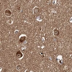 Immunohistochemical staining of human cerebral cortex using Anti-TOLLIP antibody HPA038621.