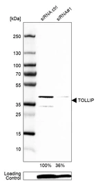 Western blot analysis in U-87MG ATCC cells transfected with control siRNA, target specific siRNA probe #1, using Anti-TOLLIP antibody. Remaining relative intensity is presented. Loading control: Anti-PPIB.