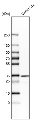 Western blot analysis in human cerebral cortex tissue.