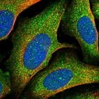 Immunofluorescent staining of human cell line U-2 OS shows localization to plasma membrane & cytosol.
