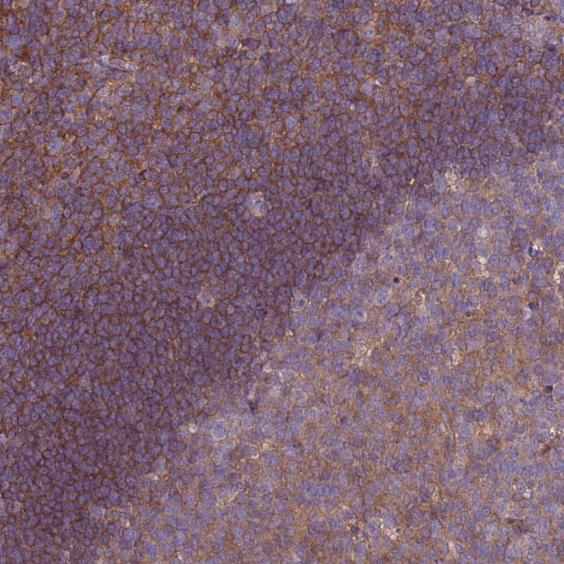 Anti-STK38L Antibody