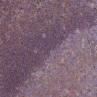 Anti-STK38L Antibody