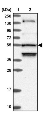 Lane 1: Marker [kDa] 250, 130, 95, 72, 55, 36, 28, 17, 10_br/_Lane 2: Human cell line RT-4