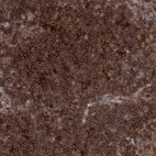 Immunohistochemical staining of human lymph node shows strong membranous positivity in non-germinal center cells.
